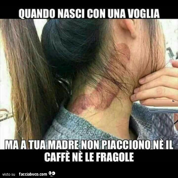 Quando nasci con una voglia