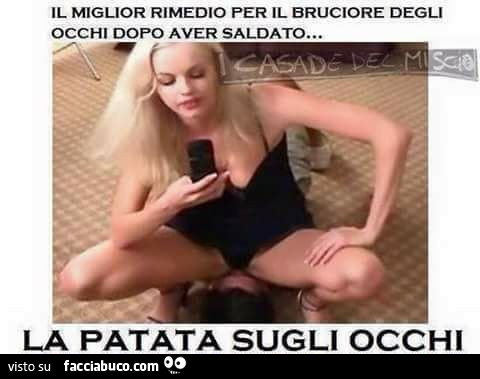 Il miglior rimedio per il bruciore degli occhi dopo aver saldato… la patata sugli occhi