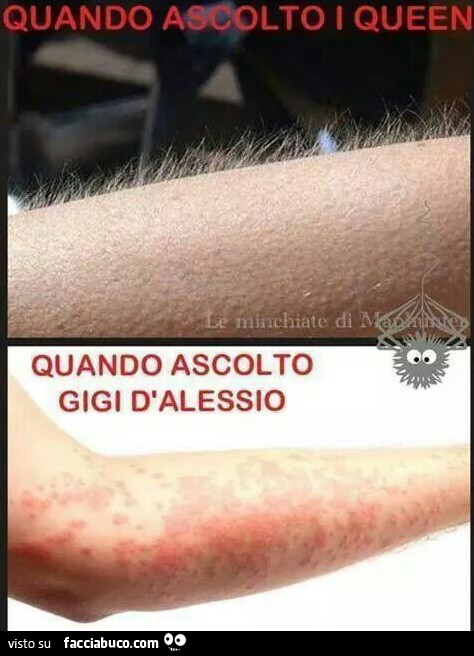 Quando ascolto i Queen. Quando ascolto Gigi D'Alessio